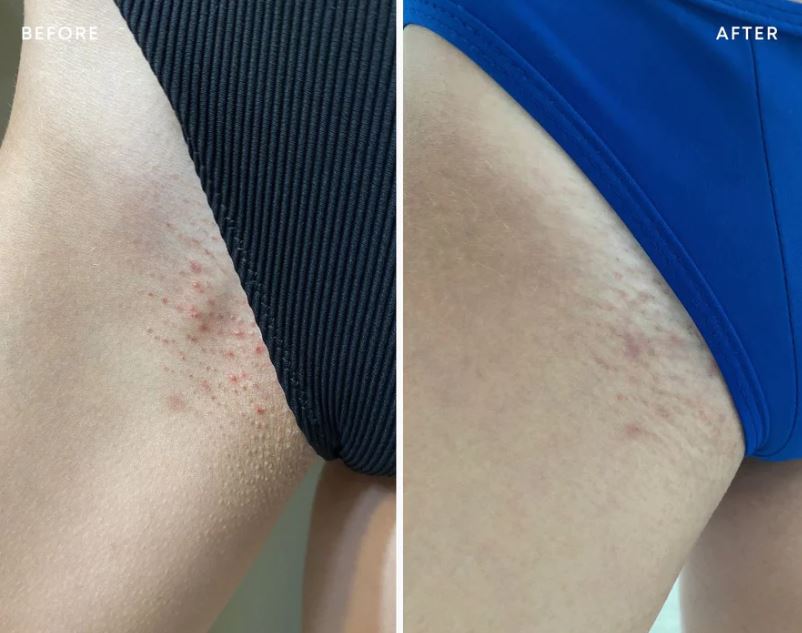 Sweet Escape Ingrown Hair & Pre-Post Wax Oil